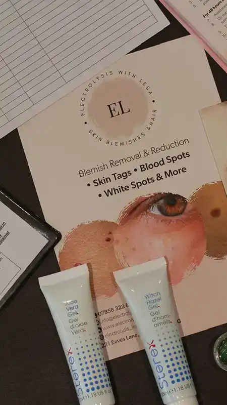 Electrolysis With Lesa - What To Expect 