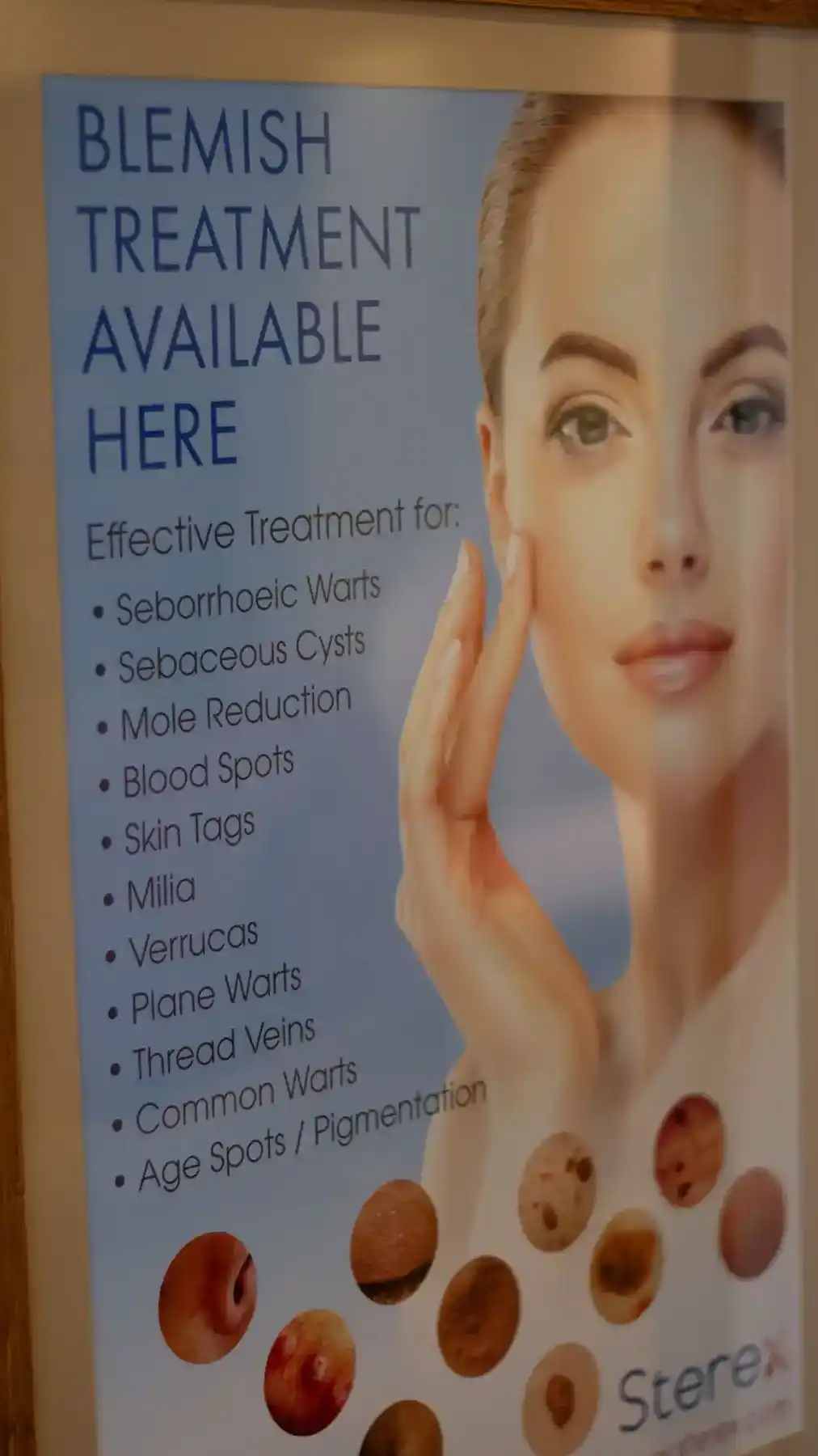 Electrolysis With Lesa - What To Expect 